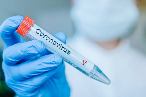 Hoitaja hengityssuojaimessa ja labotaattorin käsineissä pitää koeputkea, jossa on positiivinen koronaviruksen testietiketti. COVID-19 tai SARS-CoV-2 diagnostinen konsepti
. - Valokuva, kuva