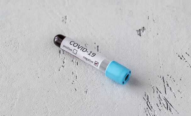 COVID-19試験用血液サンプル付き試験管。陰性のテスト. - 写真・画像