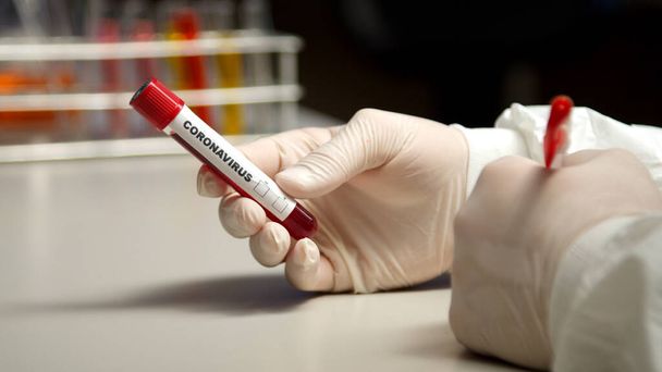 Wissenschaftler markieren mit Stift Coronavirus Reagenzglas - Foto, Bild