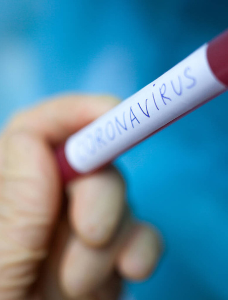 Main dans des gants médicaux tenant une éprouvette sanguine avec des résultats pour l'infection par le coronavirus (Covid-19). Éclosion de coronavirus
. - Photo, image