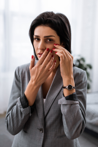 upset businesswoman touching face with bruise, domestic violence concept  - Fotografie, Obrázek