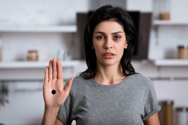 mujer molesta con moretones en la cara y punto negro en la palma de la mano, concepto de violencia doméstica
  - Foto, Imagen