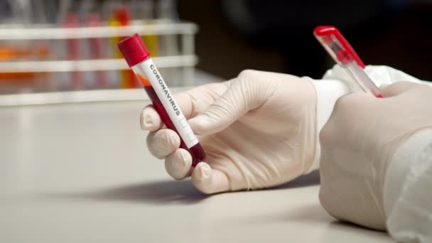 Scientist marking Coronavirus test tube - Кадри, відео
