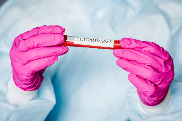 Epidemic Corona virus. Doctor holding a blood test, positive result, rapidly spreading Coronavirus, China. Tube with sample blood for 2019-nCoV. - Photo, image