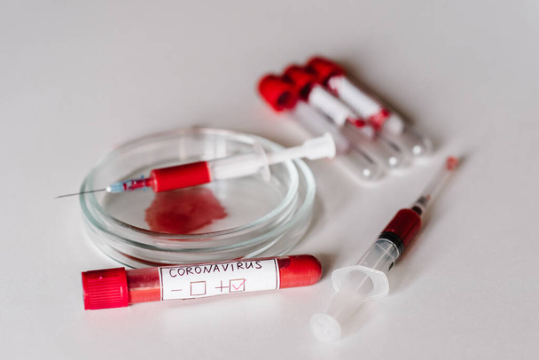 Coronavirus. Tubo con muestra de sangre para 2019-nCoV. Muestra en jeringa para infección contaminada por el virus Corona. Realizar pruebas de laboratorio - Resultado positivo
. - Foto, imagen