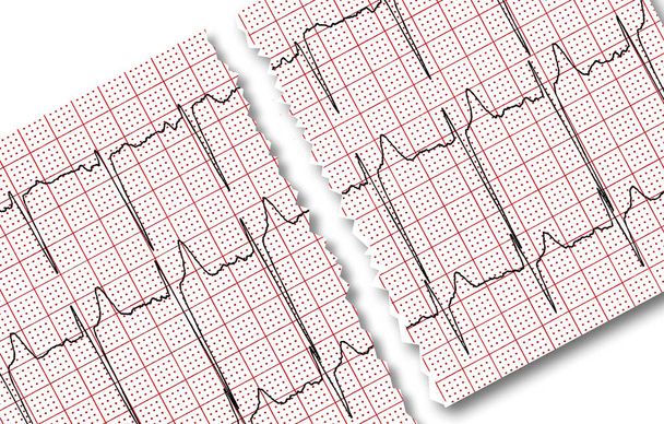 Cardiogram. The result of research by CU is torn in half it is isolated on a white background. - Photo, Image