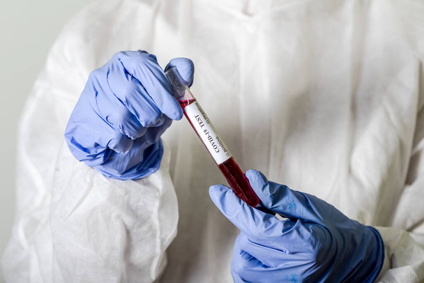 Врач в защитном износе держит пробирку с кровью для анализа коронавируса COVID-19. Китайская коронавирусная концепция. Вакцина от гриппа, коронавируса, эболы
. - Фото, изображение