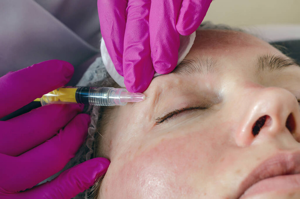 Žena obličej dělá kosmetické injekce kolem očí, stříkačky, léky, omlazení. - Fotografie, Obrázek