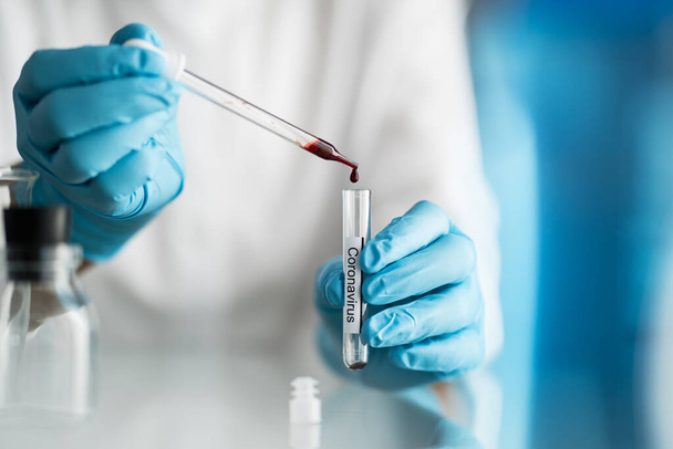 tudós kezében vérkémcső covid-19 vagy coronavírus címkével, laboratóriumi vizsgálatok feltalálására pandémiás gyógyszer - Fotó, kép