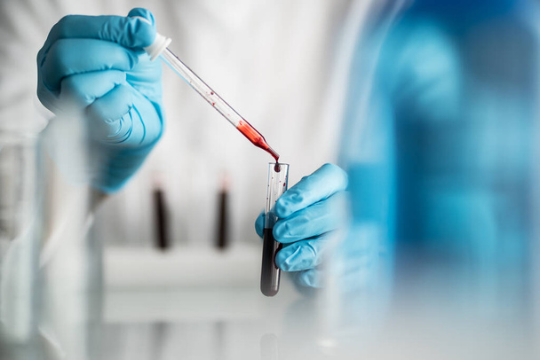scientist holding blood test tube, lab testing for medication - Foto, afbeelding