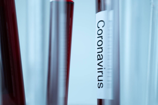 макрозйомка ковідо-19 або коронавірусна етикетка на пластиковій трубці
 - Фото, зображення