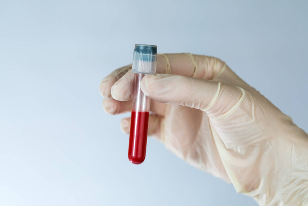 Rurka testowa z próbką krwi w rękach pielęgniarki. Badanie krwi na obecność wirusów w klinice z zachowaniem środków ostrożności. - Zdjęcie, obraz