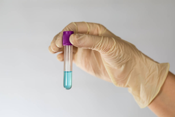 Tubo di prova con liquido chimico trasparente blu nelle mani di uno scienziato. Mani in guanti di lattice. Tubo di prova sotto vuoto
. - Foto, immagini