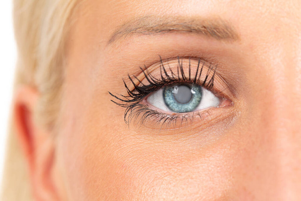 Catarac on woman eye - Fotografie, Obrázek