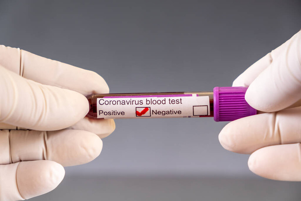 Вірус Корони Ковід-19 Аналіз крові. У табусі є зразок крові, який позитивний для коронавірусу.. - Фото, зображення