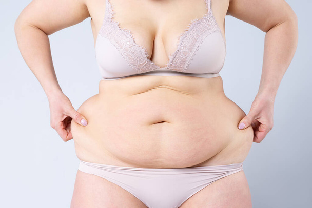 Tummy tuck, peau flasque sur un ventre gras, concept de chirurgie plastique sur fond gris - Photo, image