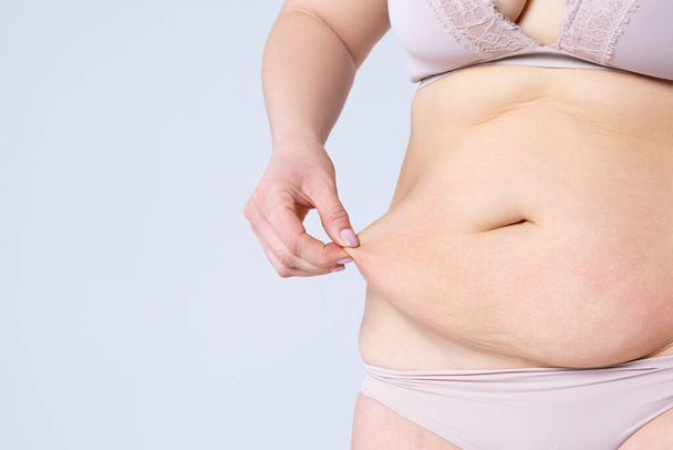 Tummy tuck, flabby skin on a fat belly, plastic surgery concept on gray background with copy space - Foto, afbeelding