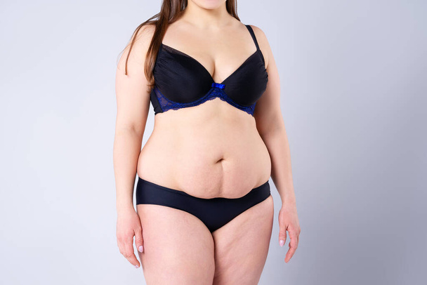 Tummy tuck, flabby skin on a fat belly, plastic surgery concept on gray background - Photo, Image