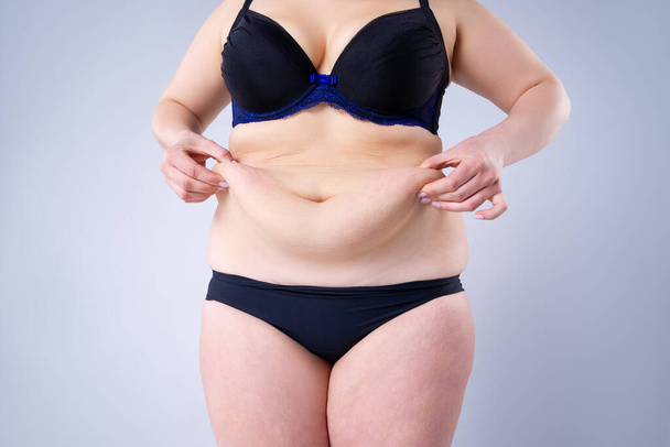 Abdominoplastia, piel flácida sobre un vientre gordo, concepto de cirugía plástica sobre fondo gris - Foto, Imagen