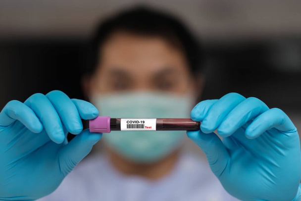 Teste de sangue de Covid-19 em laboratório hospitalar
  - Foto, Imagem