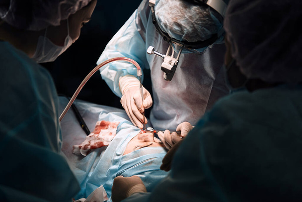 A shot of an emergency and a serious accident in the operating room, a team of surgeons makes an emergency operation to people in an accident. Saving lives, modern medetsina. - Photo, Image