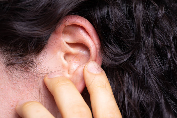 A young Caucasian girl, hard of hearing, is seen close up pointing towards her ear with her fingers. Small white pimples can be seen inside the ear. - Photo, Image