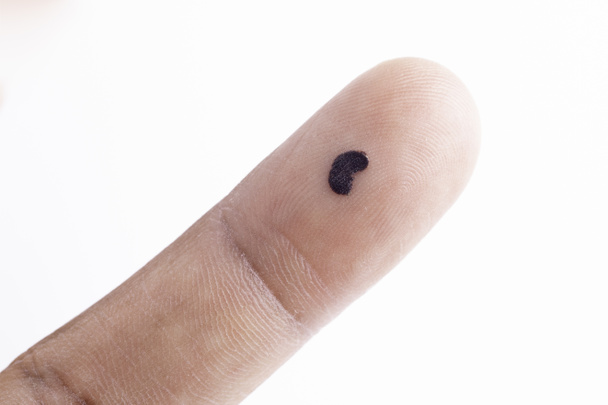Black spot on finger close up - Foto, imagen