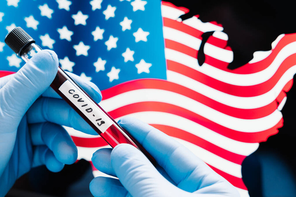 Koronaviruksen puhkeaminen Yhdysvalloissa. Luovuttakaa lääkintähanskat, joissa on näyteverta putkessa Amerikan Yhdysvaltojen lipun alla. Covid-19:n verikoe
 - Valokuva, kuva
