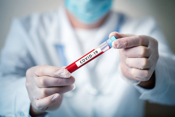 The epidemic of coronavirus. The doctor keeps a blood test. - Фото, изображение