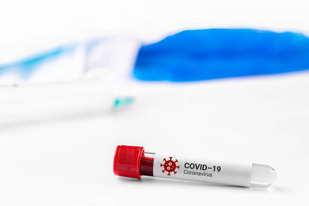 Test tube with blood test for coronavirus 2019-nCov. Covid-19 respiratory disease outbreak. SARS. - Photo, Image