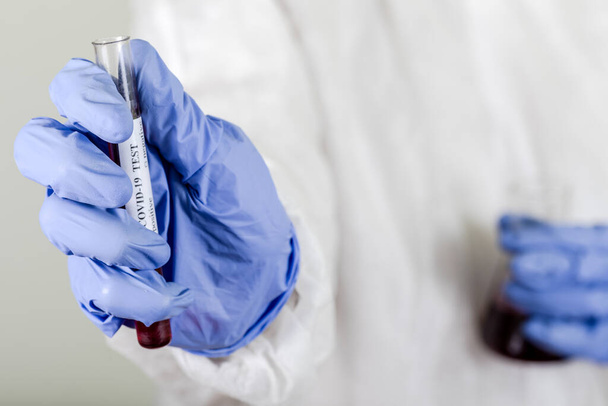 Doutor em desgaste protetor segurando tubo de teste com sangue para análise de Coronavirus COVID-19. Vacina, gripe, coronavírus, ebola
. - Foto, Imagem