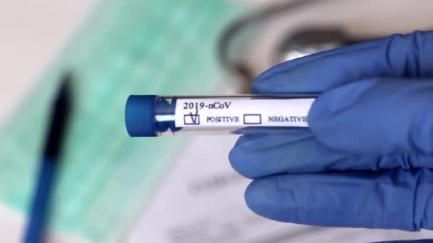 Conceptual photography - testing for coronavirus. In the hand is a test tube with a sample of the patient. The result of the analysis is POSITIVE. Tasting tested positive for coronavirus (COVID-19). - Video