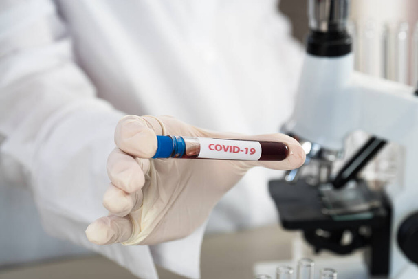Nurse holding test tube with blood for nCoV-2019 analyzing, coronavirus test concept in laboratory - Фото, зображення