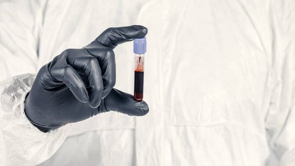 Egy kémcső egy férfi kezében közelkép, egy férfi orvosi maszkban, kezében egy üveg vörös folyadékkal. A vérminták fogalma, orvosi és kémiai kutatás. - Fotó, kép