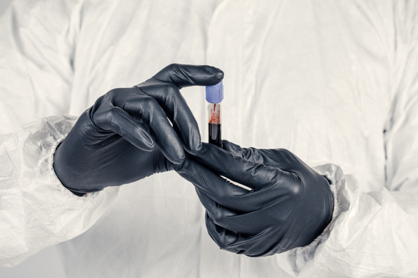 Um tubo de ensaio na mão de um homem de perto, um homem com uma máscara médica a segurar uma garrafa de líquido vermelho. Conceito de amostras de sangue, pesquisa médica e química
. - Foto, Imagem