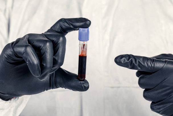 Rurka testowa w zbliżeniu ręki mężczyzny, mężczyzna w masce medycznej trzymający butelkę czerwonego płynu. Koncepcja próbek krwi, badania medyczne i chemiczne. - Zdjęcie, obraz