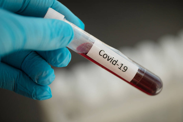 Equipo médico. Análisis de sangre. Covid-19. Virus Corona
. - Foto, Imagen