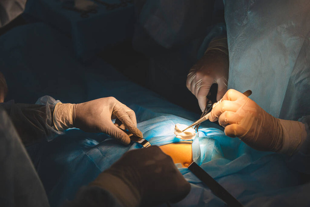 Close-ups of doctors hands in medical gloves during surgery - Foto, Imagem