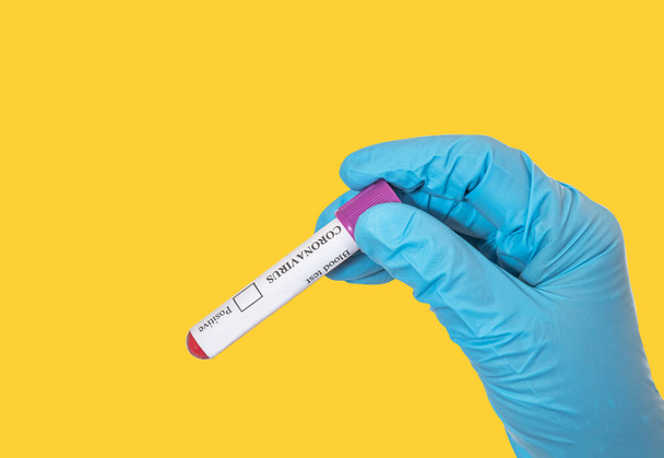 Médico mano usar guantes azules sosteniendo tubo de ensayo infectado sangre muestra investigación vacuna coronavirus enfermedad concepto
 - Foto, Imagen