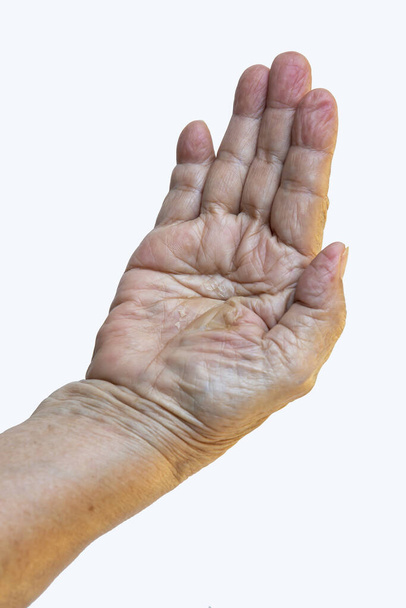 Senior woman has Dry hand and Peel in the middle of the palm, Dermatitis, Skin infections, Close up shot, Healthcare concept - Fotó, kép