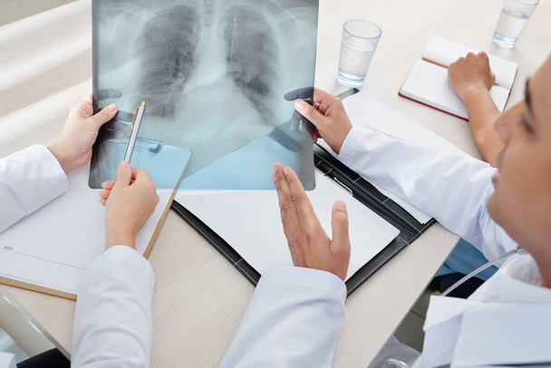 Radiografía de los pulmones del paciente con neumonía en manos de médicos generales que discuten los síntomas
 - Foto, imagen