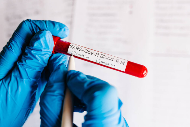 Coronavirus. A hand of doctor, nurse writing a note with a pen, holds a tube containing a patient's blood sample at the laboratory. SARS-Cov-2. Conduct laboratory testing - Positive results. - Foto, afbeelding