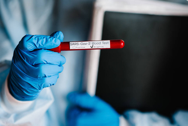 Coronavirus. A hands of Doctor, nurse, scientist in a protective suit hold a test tube with biological sample. SARS-Cov-2. Conduct laboratory test - negative result. The news of the day is an update. - Foto, afbeelding