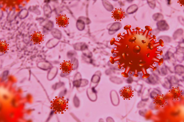 Хвороба корони COVID-19, медична ілюстрація. Нова офіційна назва вірусу Корони COVID-19, ризик пандемії. - Фото, зображення