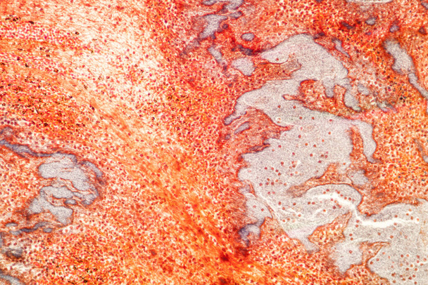 Tlustá srdeční tkáň pod mikroskopem 100x - Fotografie, Obrázek