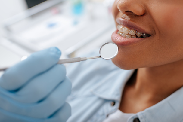Ausgeschnittene Ansicht eines Kieferorthopäden im Latexhandschuh, der einen Zahnspiegel in der Nähe eines glücklichen afrikanisch-amerikanischen Patienten in Zahnspange hält - Foto, Bild