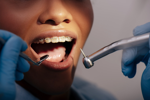 vista ritagliata di ortodontista in guanti di lattice in possesso di strumenti dentali vicino felice donna africana americana in bretelle
  - Foto, immagini