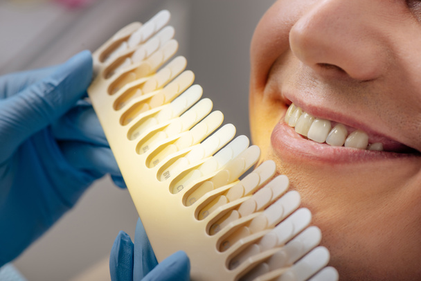 περικοπή άποψη του οδοντιάτρου σε γάντια λατέξ κρατώντας τα δόντια παλέτα κοντά χαμογελαστός άνθρωπος  - Φωτογραφία, εικόνα