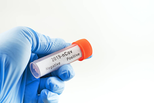 Konzeptfoto. Coronavirus-Test: Eine Hand hält ein Reagenzglas mit einer Patientenprobe - Foto, Bild