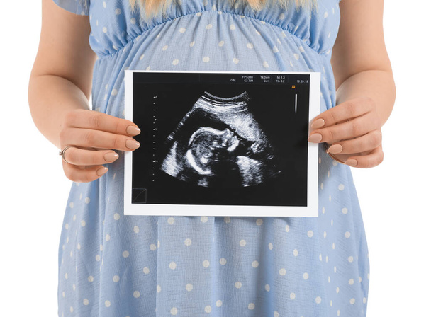 Beautiful pregnant woman with sonogram image on white background - Photo, Image